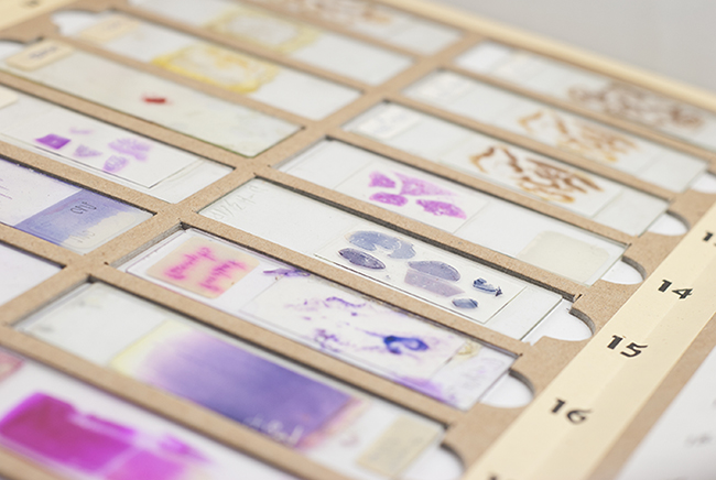 stained slides HSR stained slides HSR